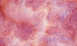 Metamorphoses Rose Dream